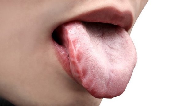 城中投资 “舌为心之苗”：心脏不好，舌头会出现4个变化，不妨自查一下