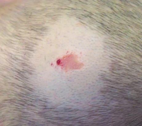 纵信优配 头上的痣暗藏癌变风险？出现这3种情况一定要警惕